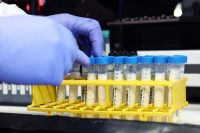 There’s still no generic Ozempic, but a lower-priced daily injected GLP-1 is coming